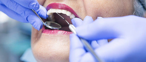 Best Urgent Tooth Repair  in Mason City, IL